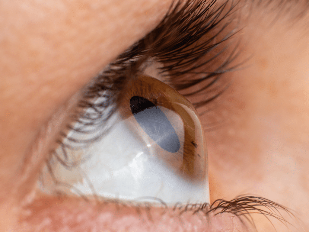 astigmatic brown eye with long eyelashes