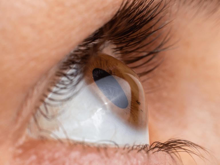 astigmatic brown eye with long eyelashes